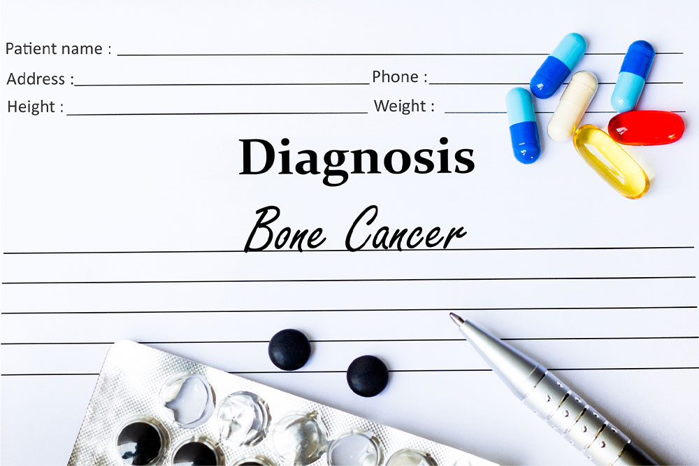 Bone cancer – Types, warning signs, lifestyle tips, and more